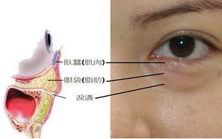 眼袋是什么