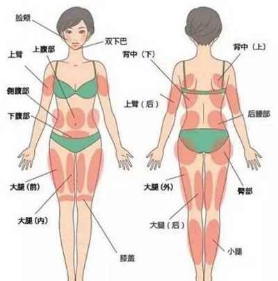 吸脂要选择好部位