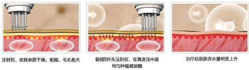 水光原理