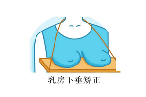 乳房下垂矫正的最佳时间是什么时候